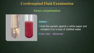 Cerebrospinal Fluid Examination (Csf) - Youtube